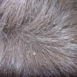 dog dandruff